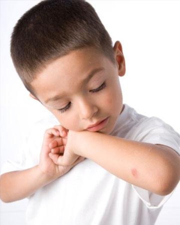 Đừng xem nhẹ vết lõm trên da