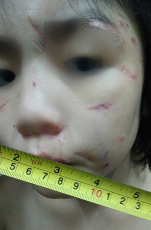 Mẹ kế khai gì về việc bạo hành bé trai 10 tuổi? - Ảnh 2.