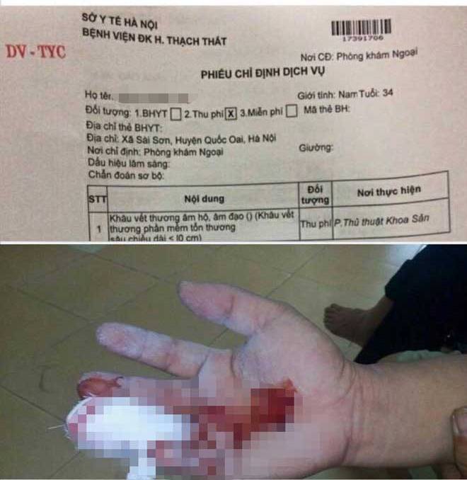 Bệnh nhân nam đứt tay, bác sĩ chỉ định "khâu âm hộ"