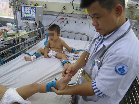 Hơn 42.700 ca tay ch&acirc;n miệng, Bộ Y tế hướng dẫn người d&acirc;n đối ph&oacute; - Ảnh 1.