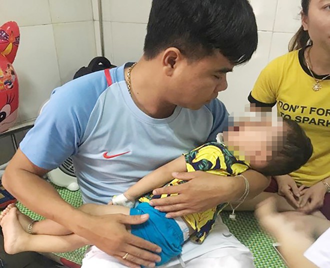 B&eacute; trai 2 tuổi bất ngờ bị ch&oacute; becgie nh&agrave; nu&ocirc;i cắn r&aacute;ch mặt - Ảnh 1.