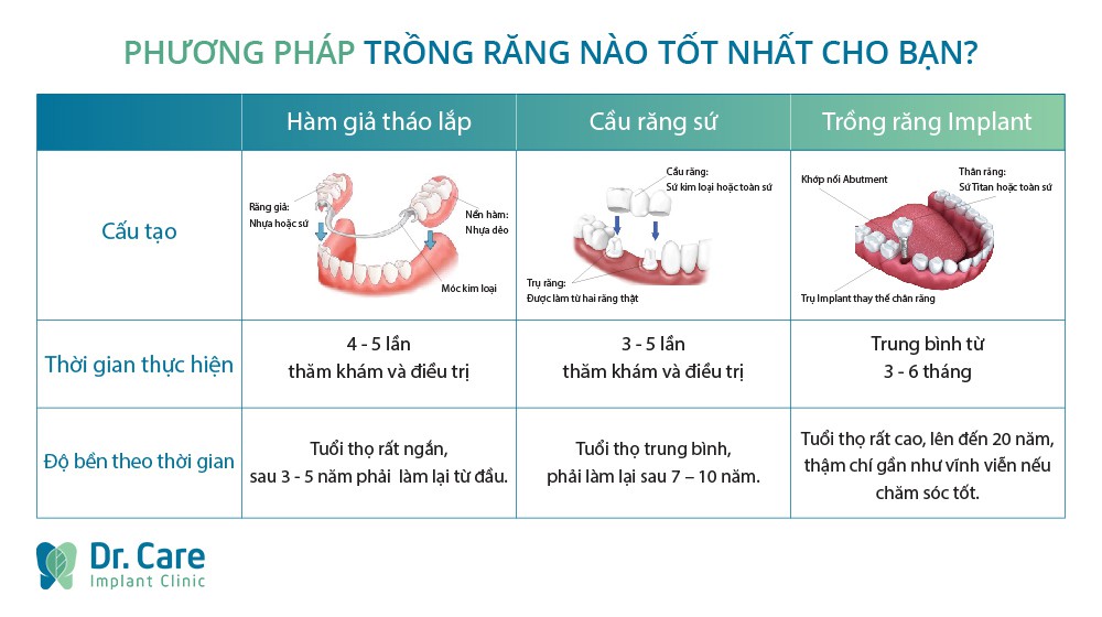 Ba lầm tưởng về phương ph&aacute;p trồng răng Implant - Ảnh 1.