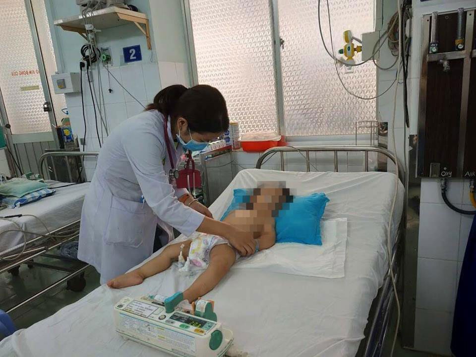 Cha mẹ chủ quan, trẻ bị tay chân miệng nặng