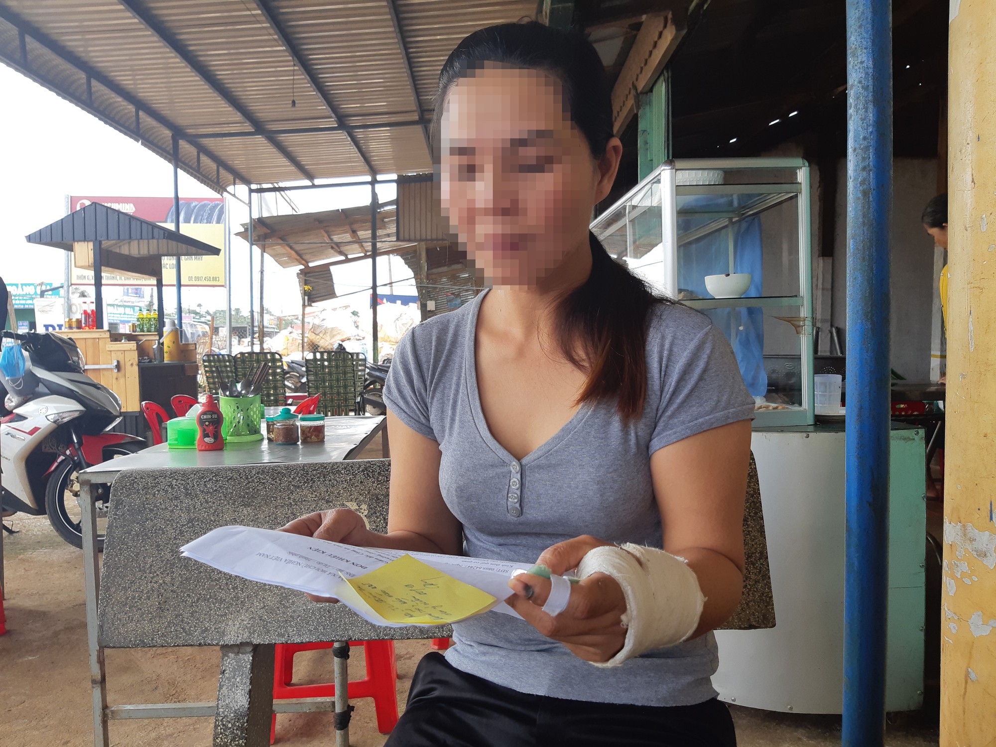 Nạn nh&acirc;n tử vong v&igrave; bị người t&igrave;nh thi&ecirc;u sống - Ảnh 1.