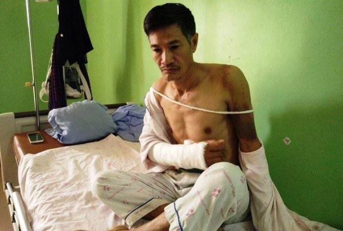 Bị ngăn chặt cây hoa sữa, 8 người xông ra đánh, chém vợ chồng hàng xóm dã man - Ảnh 3.