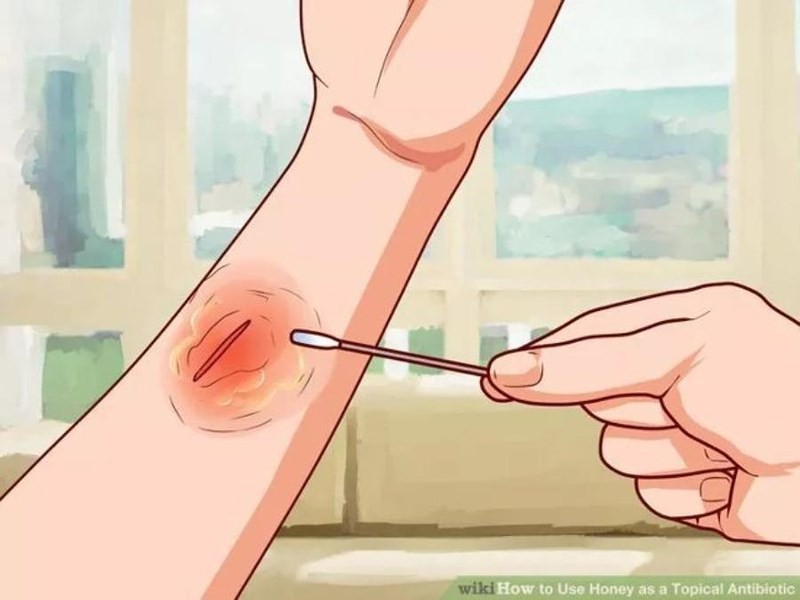Muốn mau l&agrave;nh vết thương, chế độ dinh dưỡng ra sao? - Ảnh 2.