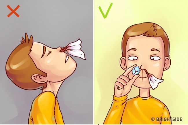 Những cách sơ cứu khẩn cấp ai cũng nên biết