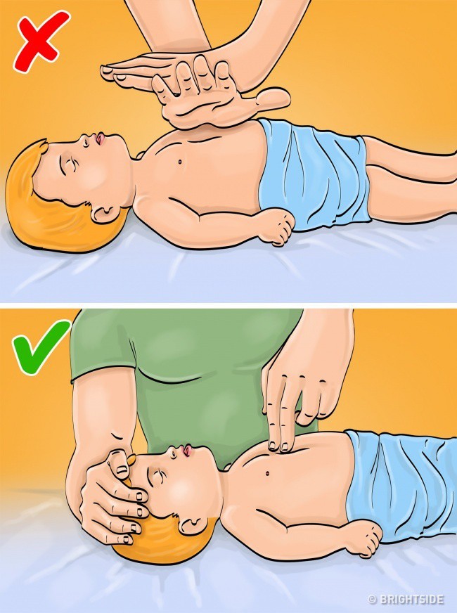 Những cách sơ cứu khẩn cấp ai cũng nên biết - Ảnh 4.