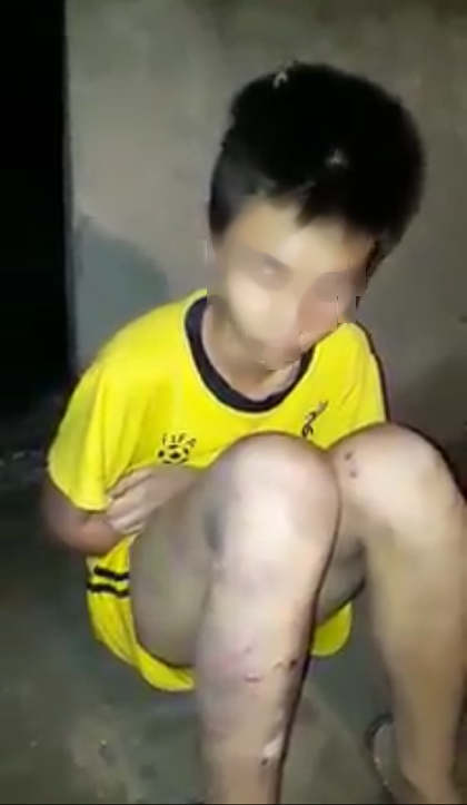 Nam sinh lớp 9 bị bố đ&aacute;nh th&acirc;m t&iacute;m người v&igrave; nghi nghiện ma t&uacute;y - Ảnh 1.