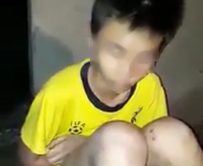 Nam sinh lớp 9 bị bố đánh thâm tím người vì nghi nghiện ma túy
