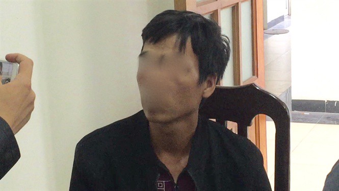 Ai b&aacute;n ma t&uacute;y c&ocirc;ng khai trước Bệnh viện 09? - Ảnh 3.