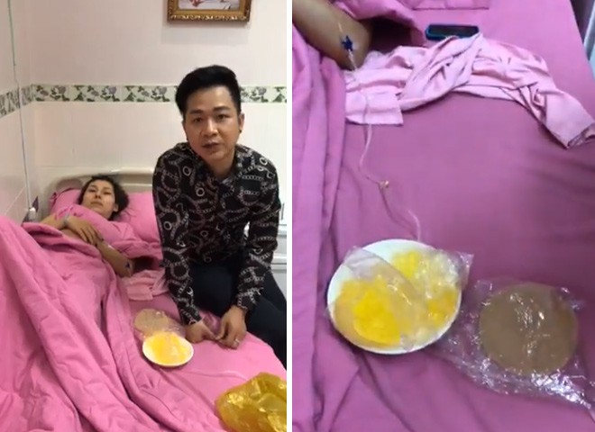 Th&aacute;nh nữ bolero dance bị nổ t&uacute;i ngực khi ở tr&ecirc;n m&aacute;y bay - Ảnh 1.