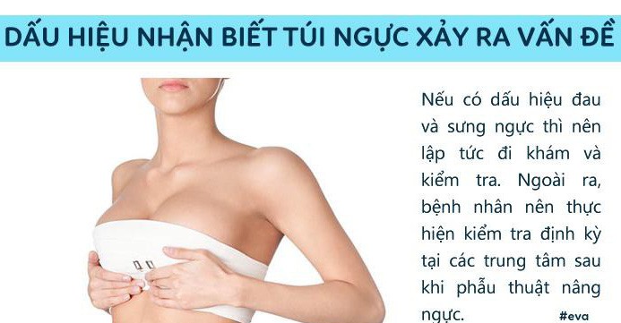 Vụ thánh nữ Bolero bị nổ túi ngực trên máy bay: Bác sĩ tiết lộ nguyên nhân - Ảnh 2.