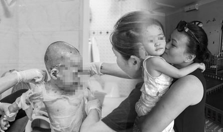 (eMagazine) - Cô tiên của trẻ mắc "bệnh lột da"