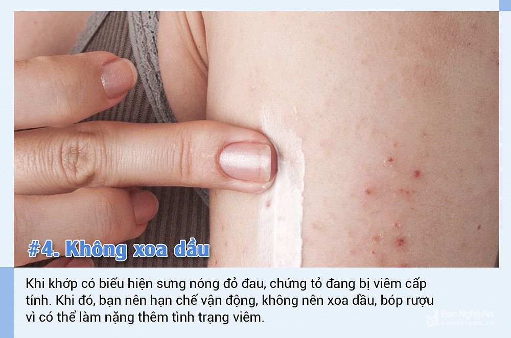 6 bước phòng bệnh xương khớp khi trời trở lạnh - Ảnh 4.