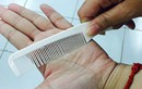 10 bệnh sẽ giảm hẳn khi dùng lược chải vào lòng bàn tay