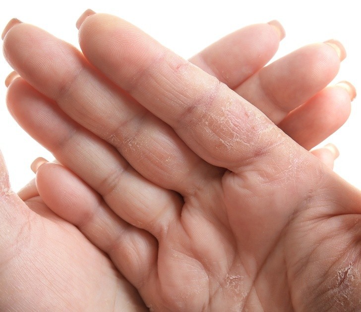 6 thay đổi cơ thể cần chú ý - Ảnh 5.