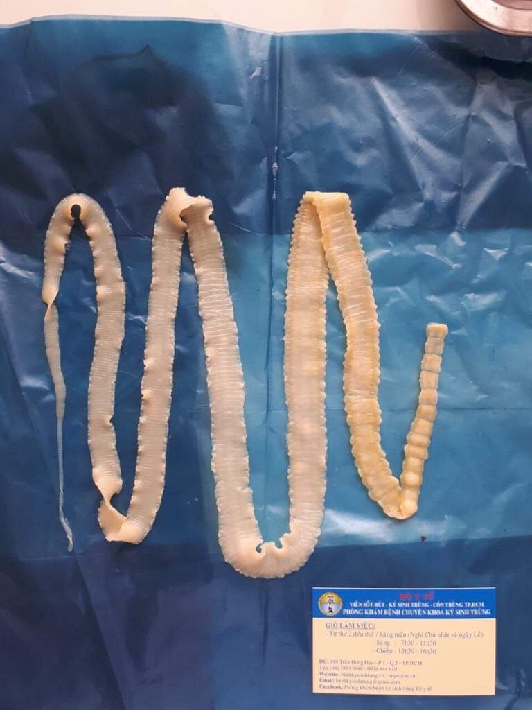 "Ớn lạnh" với ổ sán lợn vừa phát hiện tại Bình Phước