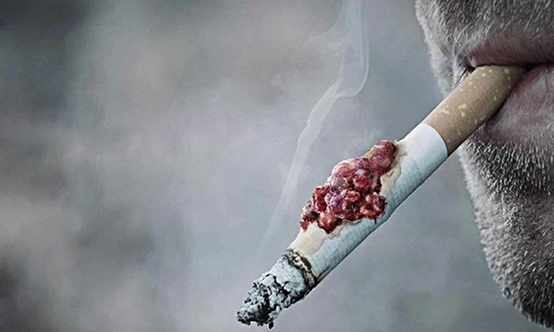 Nam thiếu ni&ecirc;n 15 tuổi bị ung thư phổi nghi h&uacute;t thuốc l&aacute; thụ động từ bố - Ảnh 2.