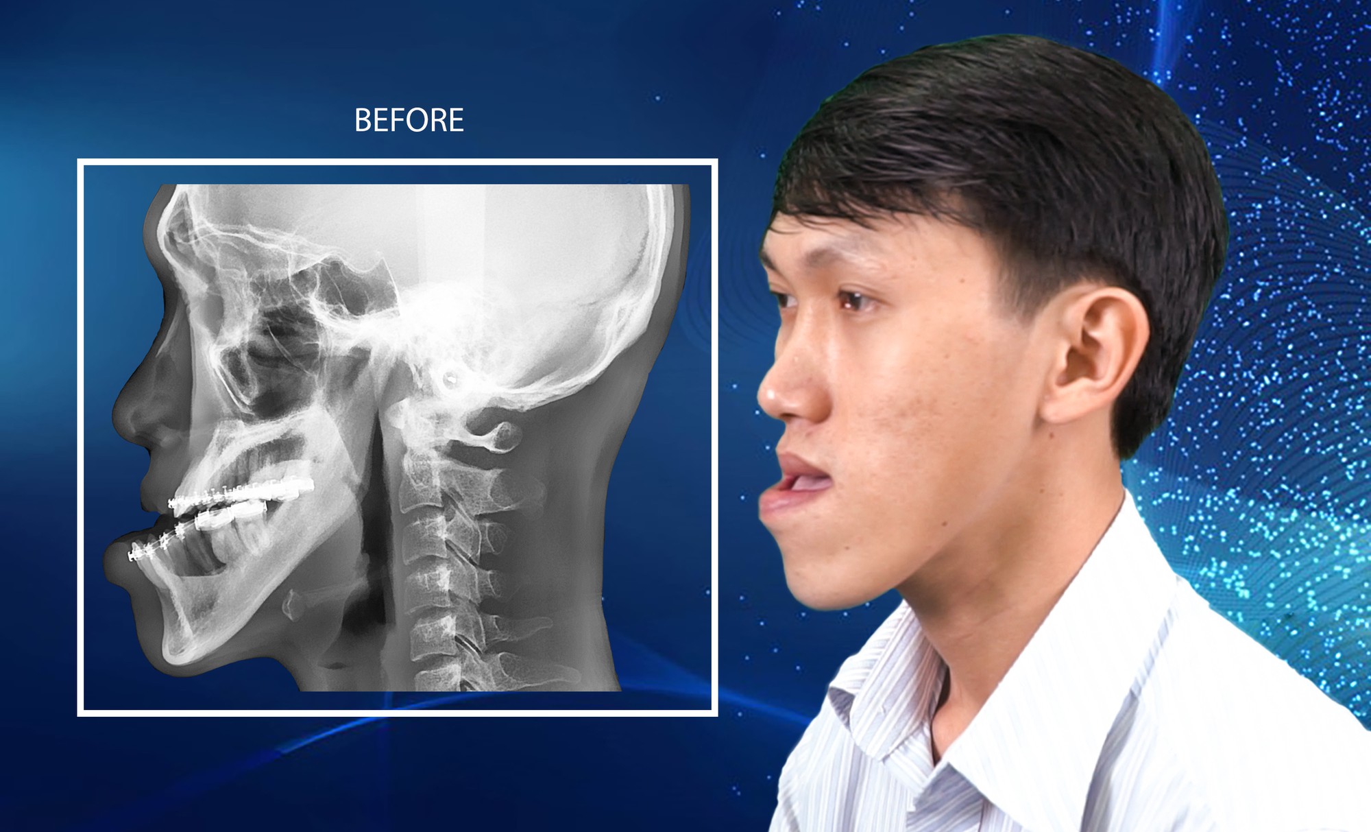 Được cắt hàm, chàng trai "xe ôm" thực hiện giấc mơ thành thạc sĩ