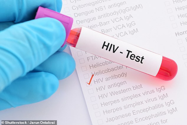 Phát hiện cơ chế giúp chữa khỏi HIV ngay trong não người