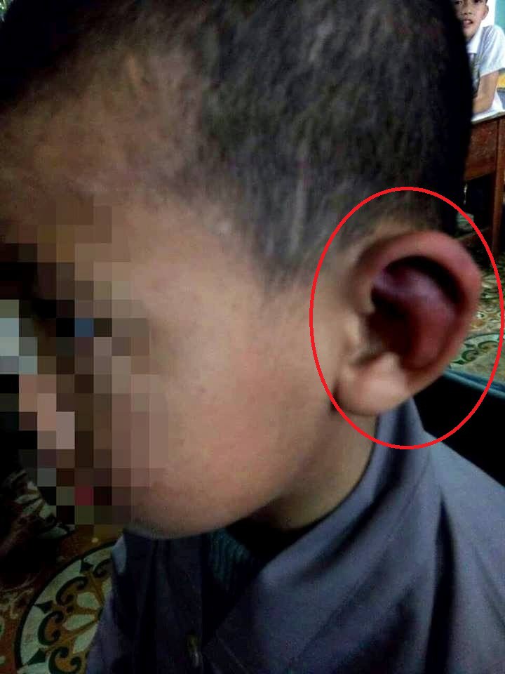 Trần t&igrave;nh của sư thầy bạo h&agrave;nh b&eacute; trai 10 tuổi th&acirc;m t&iacute;m khắp người - Ảnh 2.