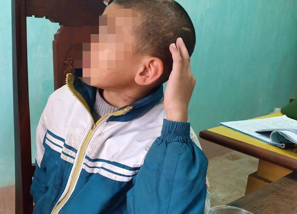 Trần tình của sư thầy bạo hành bé trai 10 tuổi thâm tím khắp người