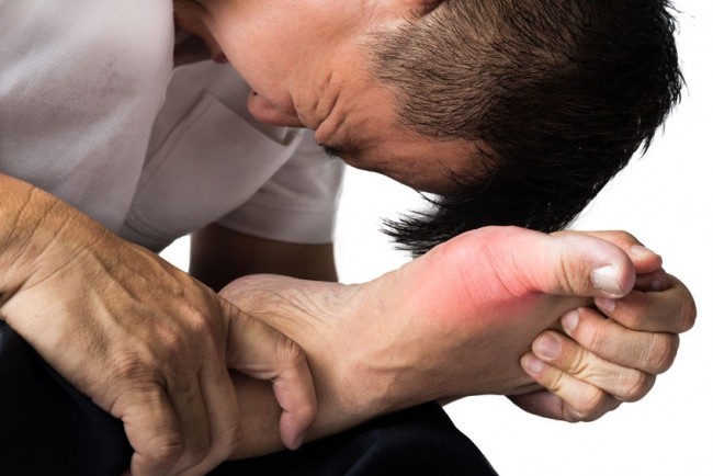 Cách nhận biết và xử lý cơn gút