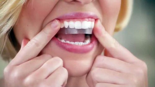 Có nên làm trắng răng "thần tốc" bằng miếng dán?