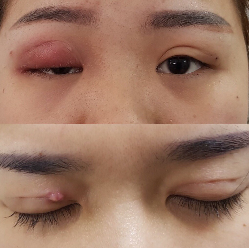 Kim kh&acirc;u g&atilde;y nằm trong mắt l&uacute;c nhấn m&iacute; - Ảnh 2.