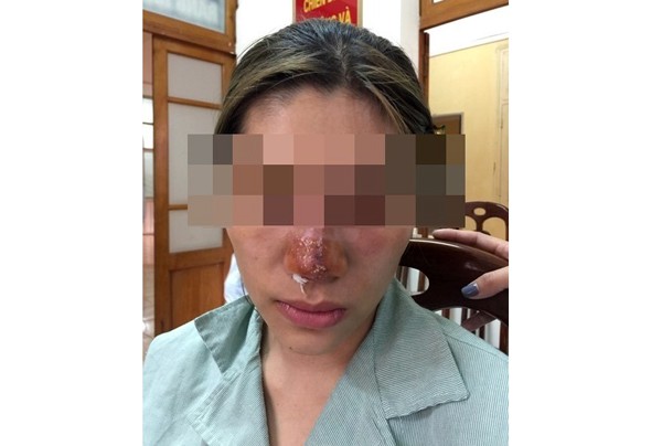 Rước họa vì ham làm đẹp giá rẻ dịp Tết - Ảnh 1.