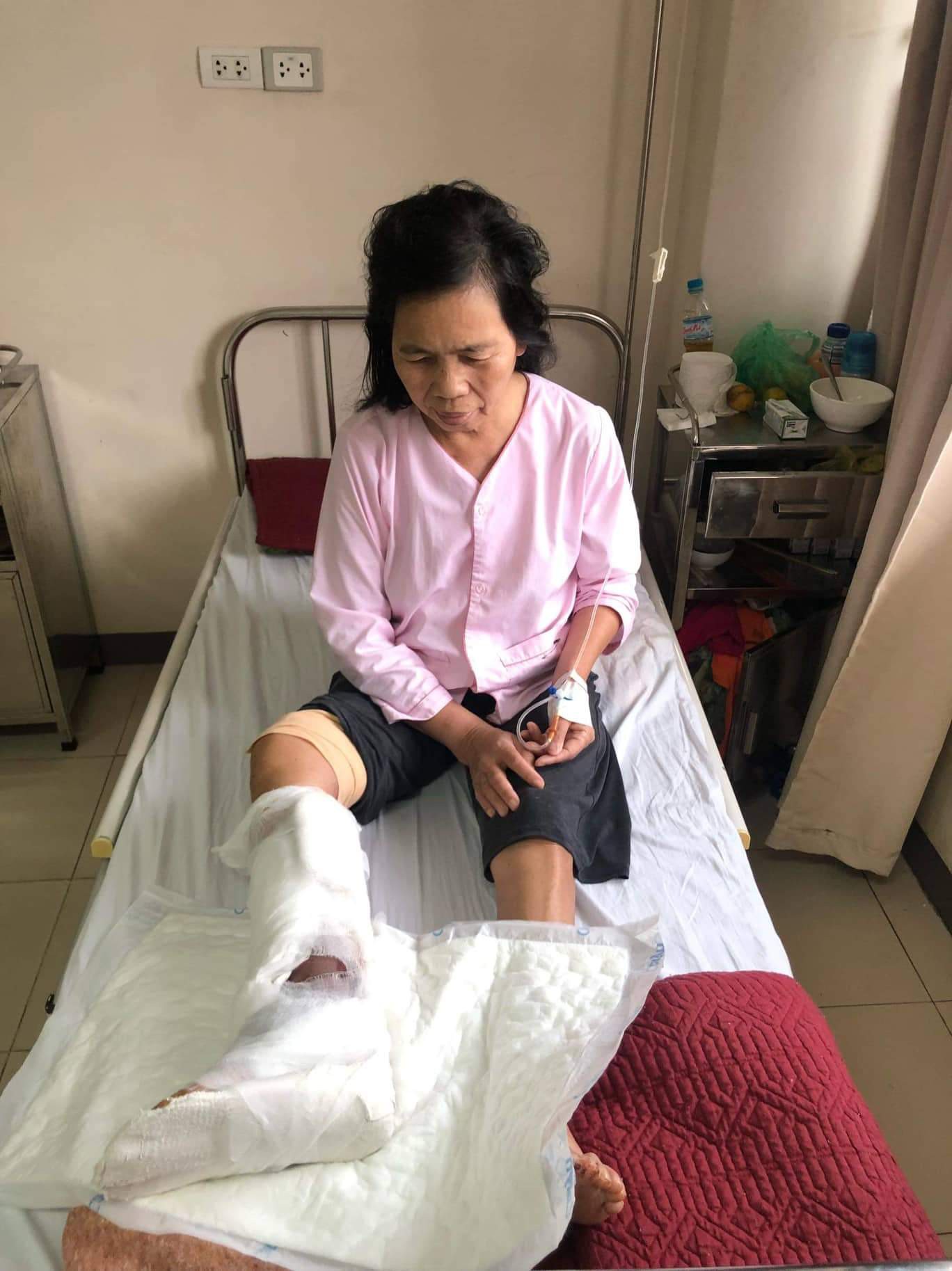 Cứu sống bệnh nhân nhiễm độc nặng sau 50 ngày bị rắn cắn - Ảnh 1.