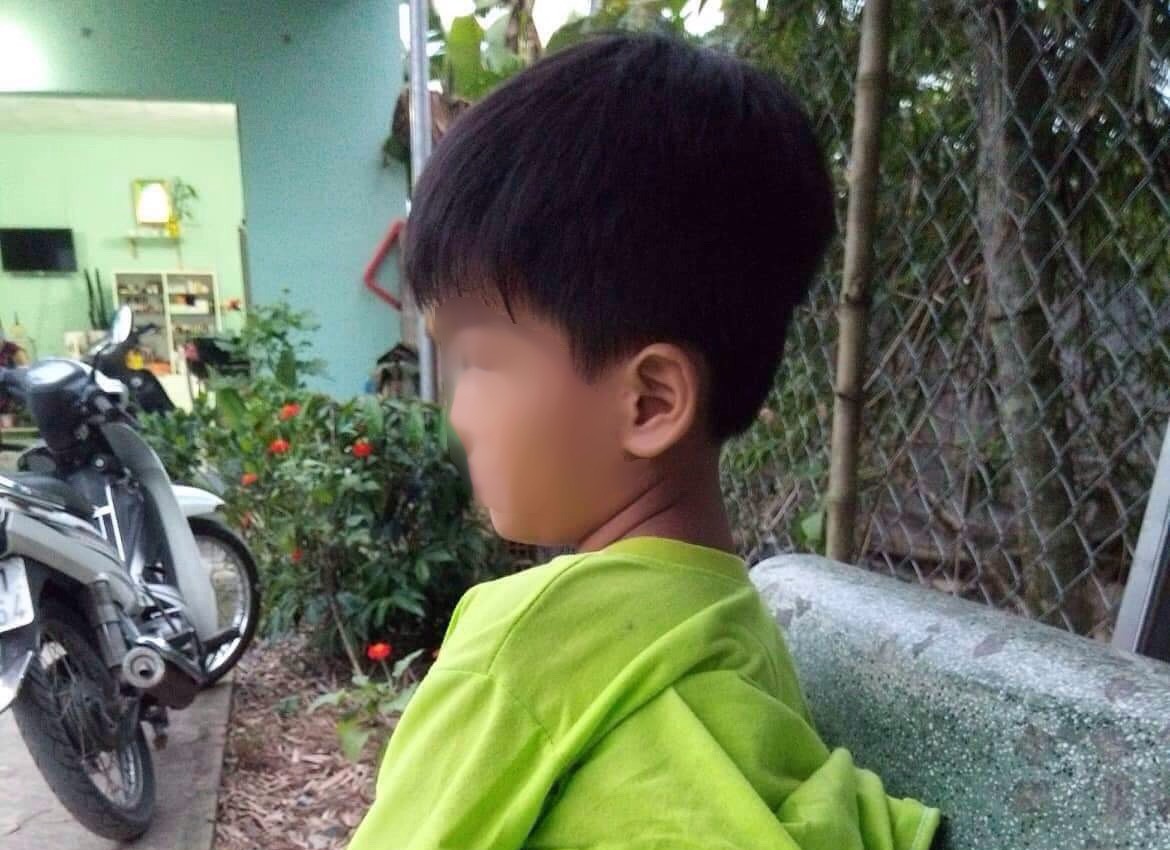 Học sinh tố bị cô giáo đánh bầm tím sườn, mông