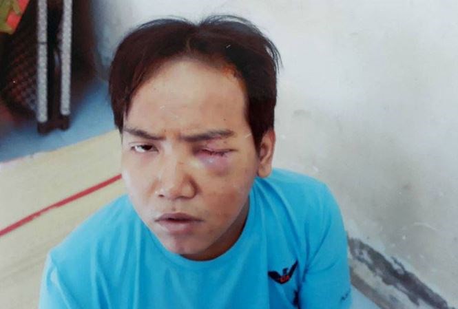 Diễn biến mới vụ bảo vệ dân phố sát hại bé 6 tuổi