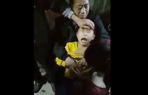 Bác sĩ nói gì về hiện tượng bé trai nghi phát bệnh dại kêu "oắc oắc"?