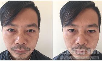 Gã đàn ông bắt người tình "bồi thường tuổi thanh xuân"