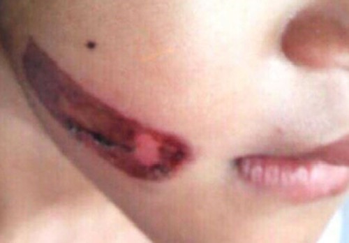 Vụ bé gái nghi bị cha ruột và mẹ kế bạo hành: Chờ chỉ đạo từ Bộ Công an