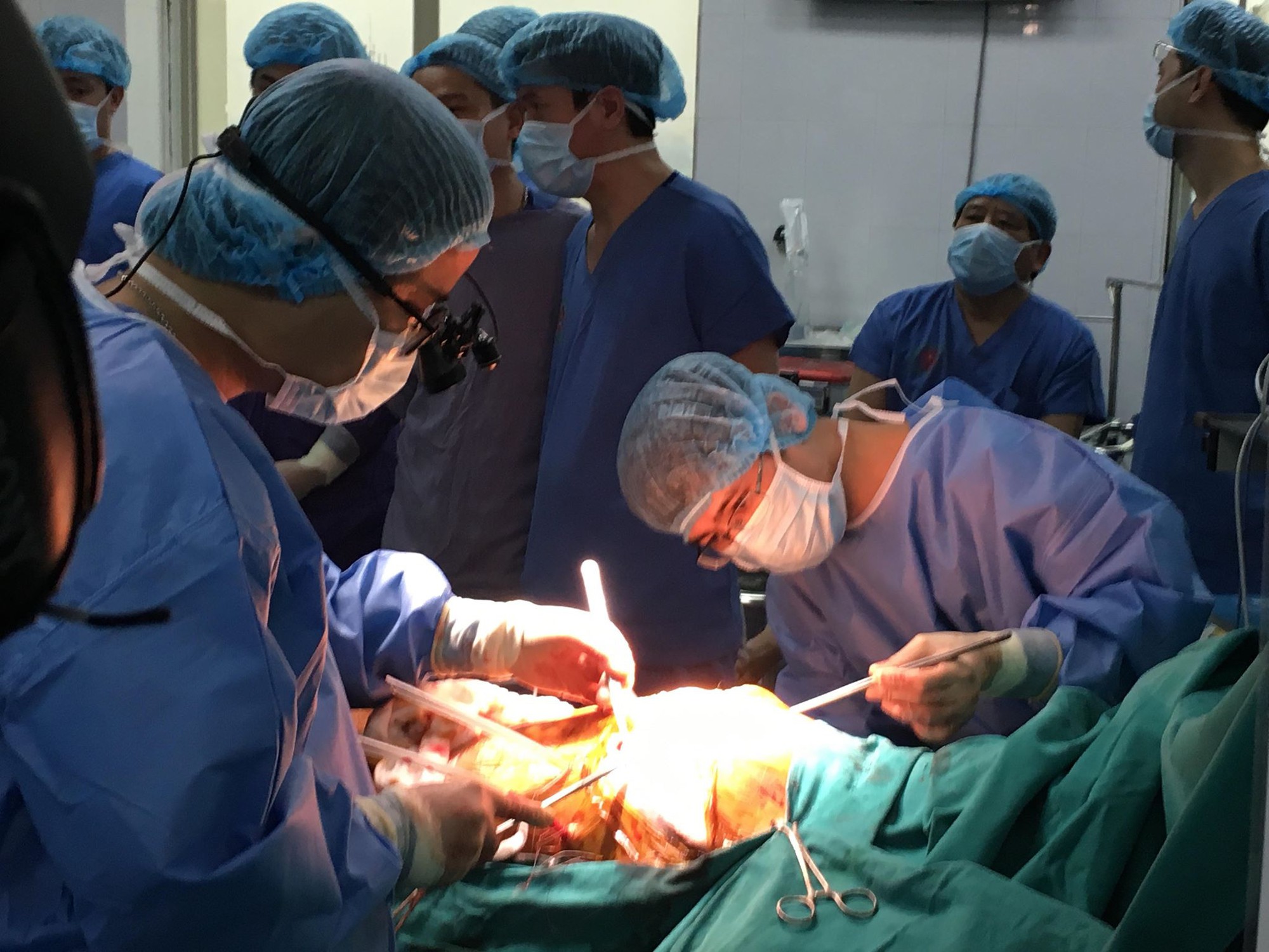 Việt Nam lần đầu ti&ecirc;n gh&eacute;p phổi từ người cho chết n&atilde;o - Ảnh 3.