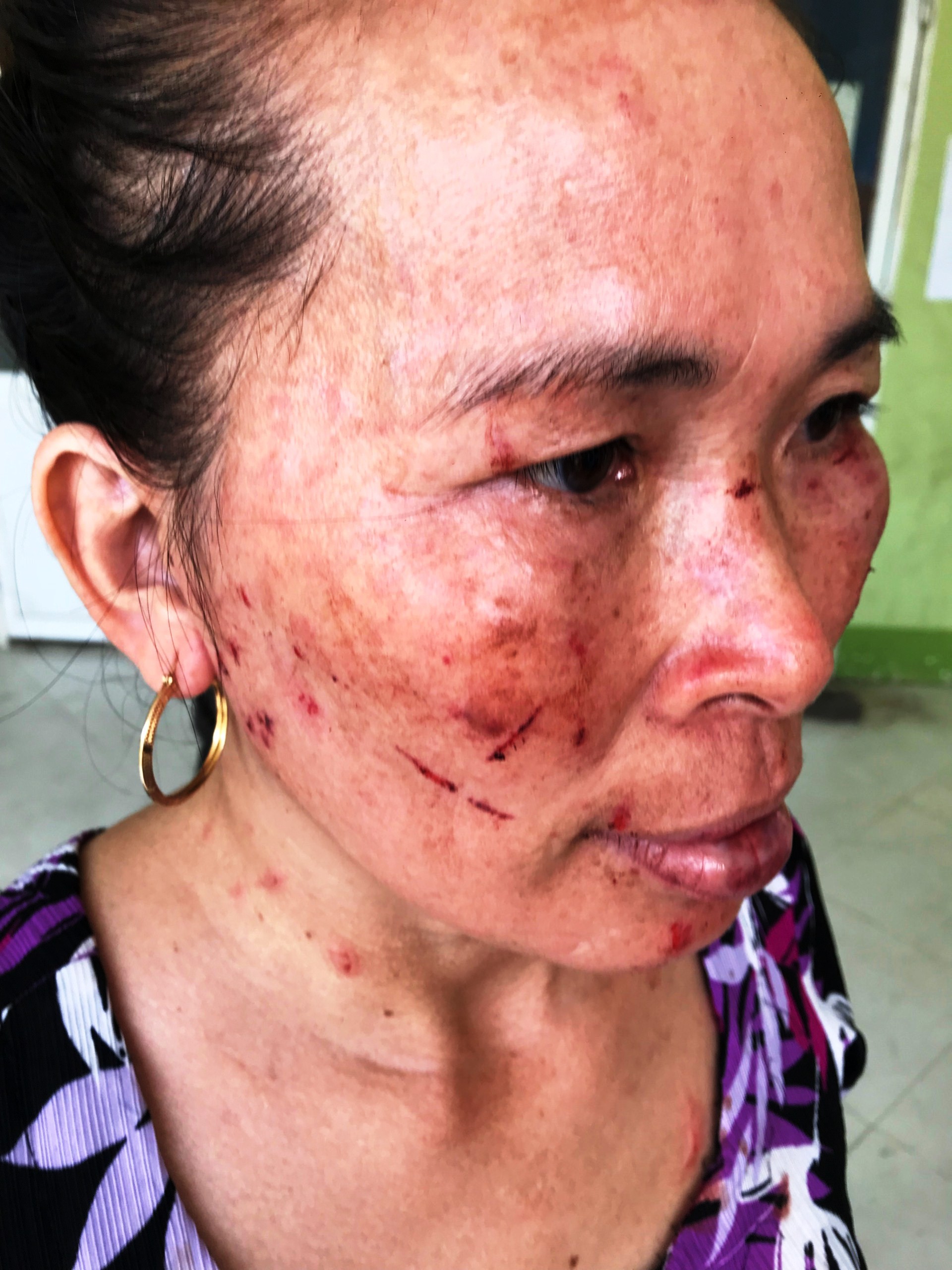 BÀ TRÙM LỘNG HÀNH Ở CẦN GIỜ: Ngóng chờ cơ quan điều tra - Ảnh 1.