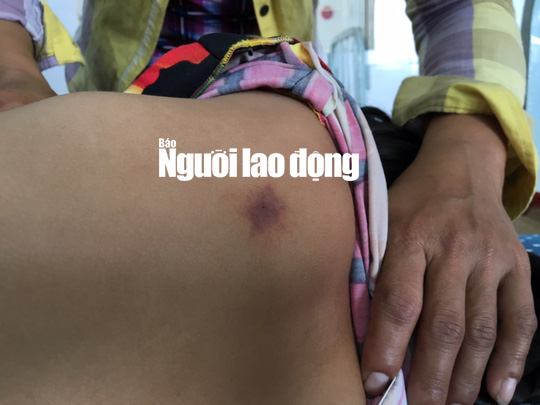 Đi học về, nữ sinh lớp 4 ngất xỉu v&igrave; bị 2 kẻ lạ vỗ v&agrave;o vai - Ảnh 2.