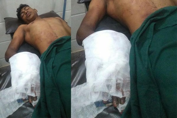 Bị cha chặt tay vì nghiện xem “phim người lớn”