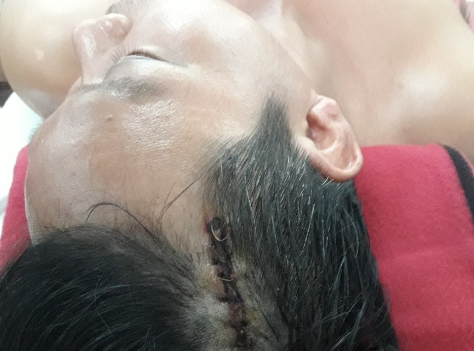 Giữa đêm, dùng roi điện "mời" công dân lên trụ sở