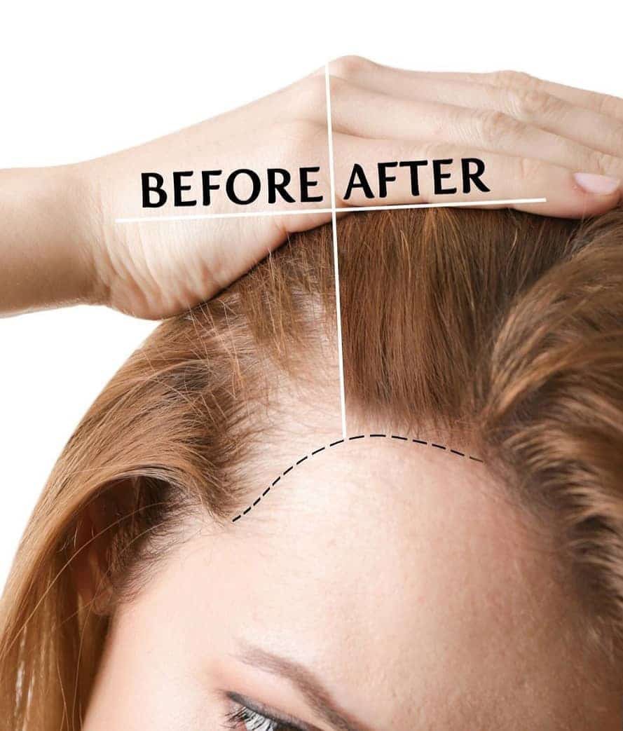 Điểm danh dưỡng chất gi&uacute;p chống rụng t&oacute;c - Ảnh 2.