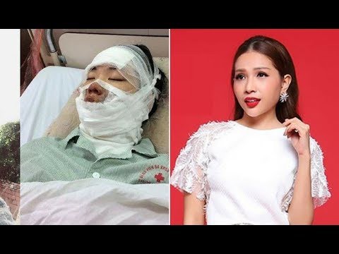 Cháy mặt một lần, Khả Như bị lửa ám ảnh