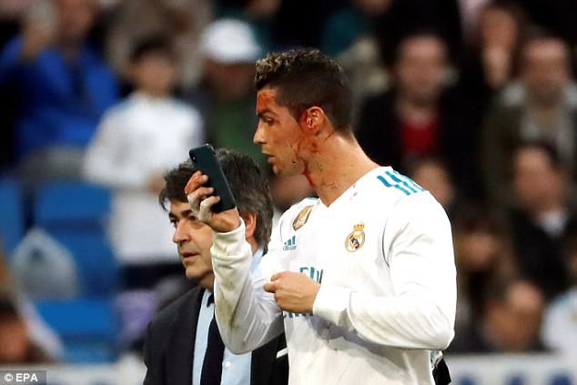 Mặt bê bết máu, CR7 vẫn điệu đà soi gương