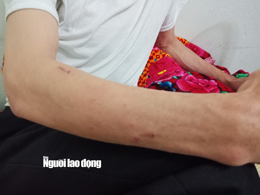 T&agrave;i xế taxi Mai Linh bị đ&aacute;nh nhập viện l&ecirc;n tiếng - Ảnh 5.