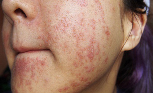 Biết những tác hại này xem chị em nào còn mê “kem trộn” - Ảnh 1.
