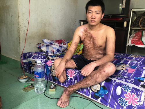 Bi kịch từ tai nạn lao động - Ảnh 1.