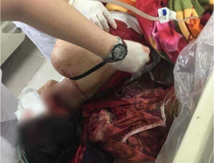 Chồng dùng dao bầu đâm vợ dã man