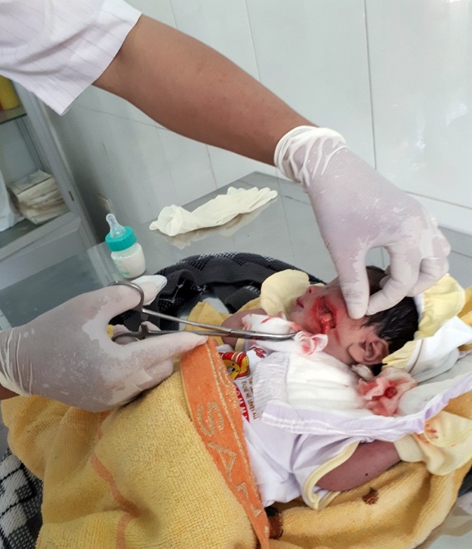 Cứu kịp thời bé sơ sinh bị chôn sống
